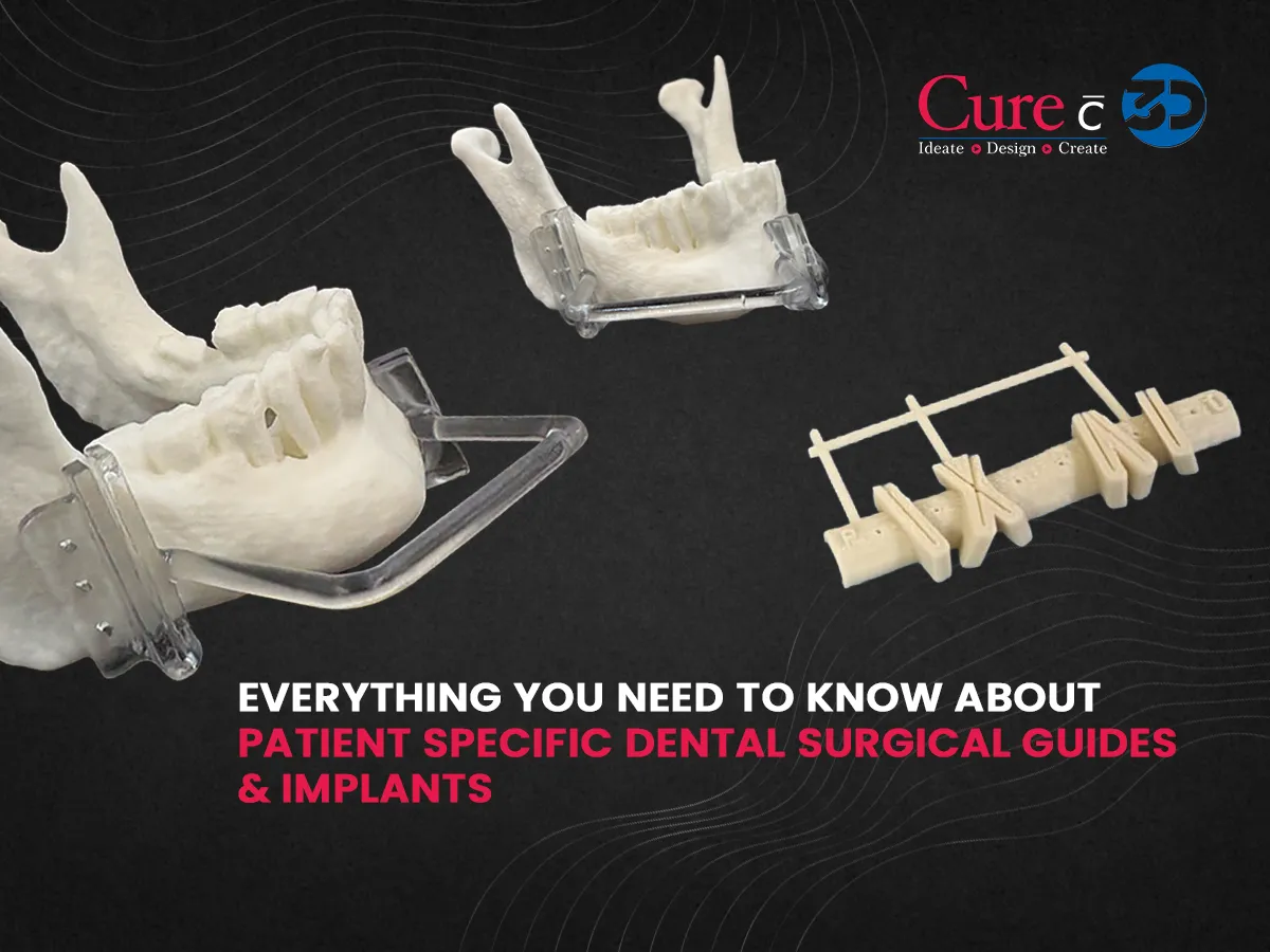 Everything you need to know about Patient Specific Dental Surgical Guides &amp; Implants 