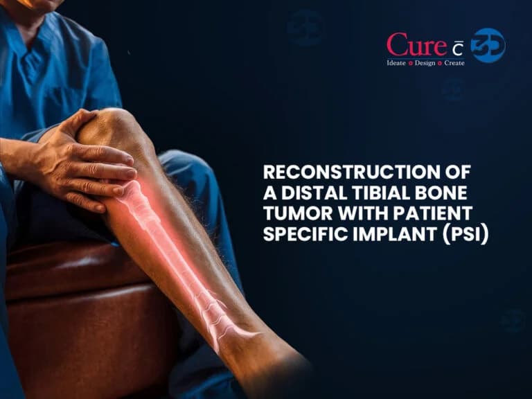 Reconstruction of a Distal Tibial Bone Tumor with Patient-Specific Implant (PSI)