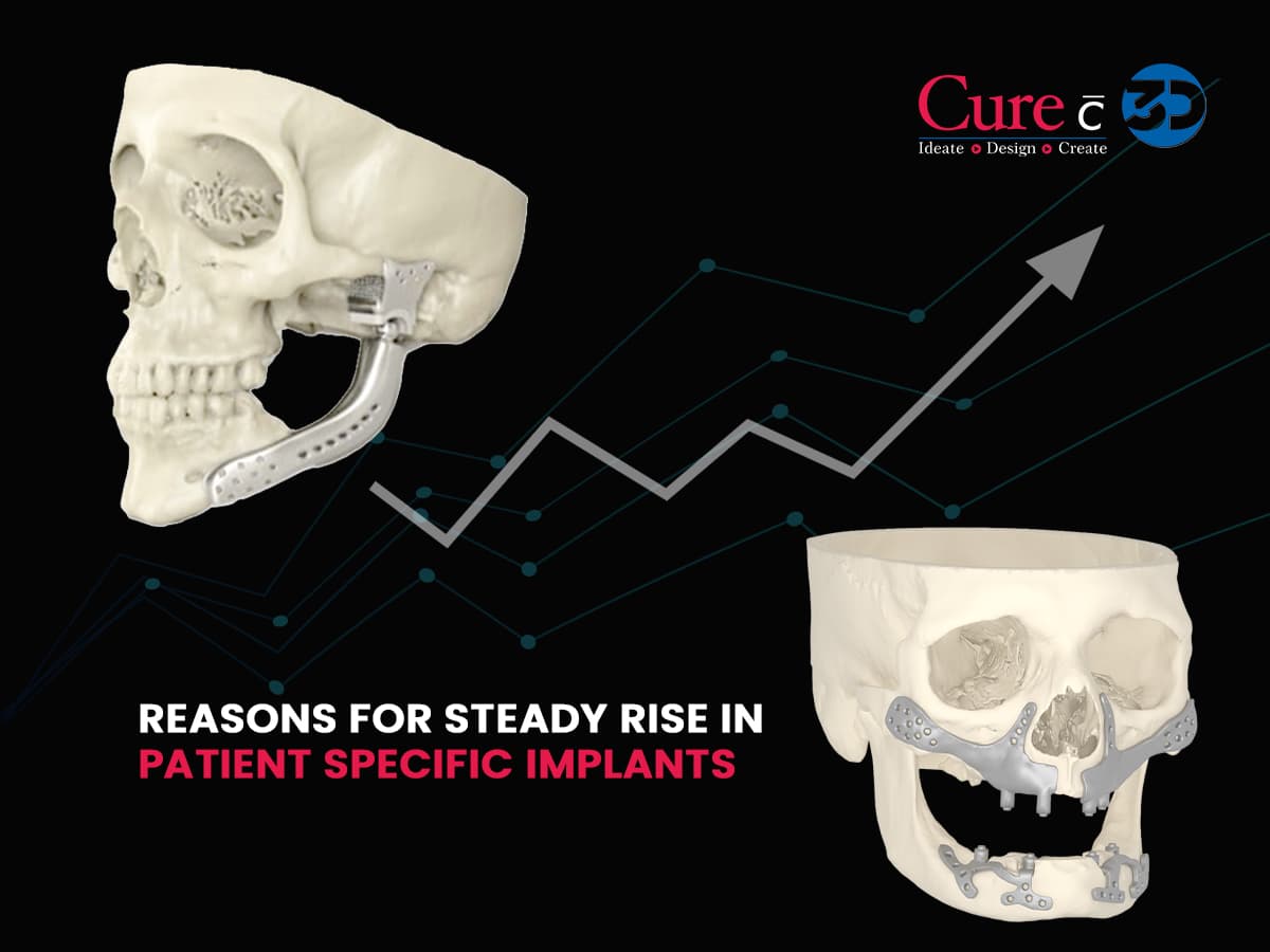 Reasons for Steady Rise in Patient Specific Orthopedic Implants