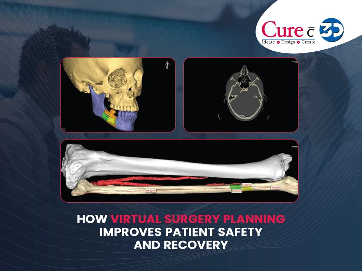 How Virtual Surgery Planning Improves Patient Safety and Recovery