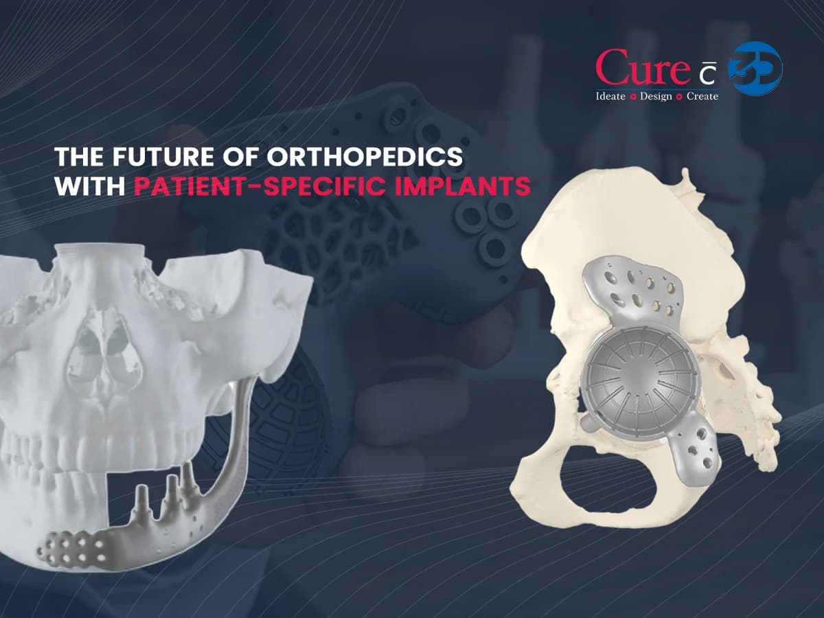 The Future of Orthopedics with Patient-Specific Implants