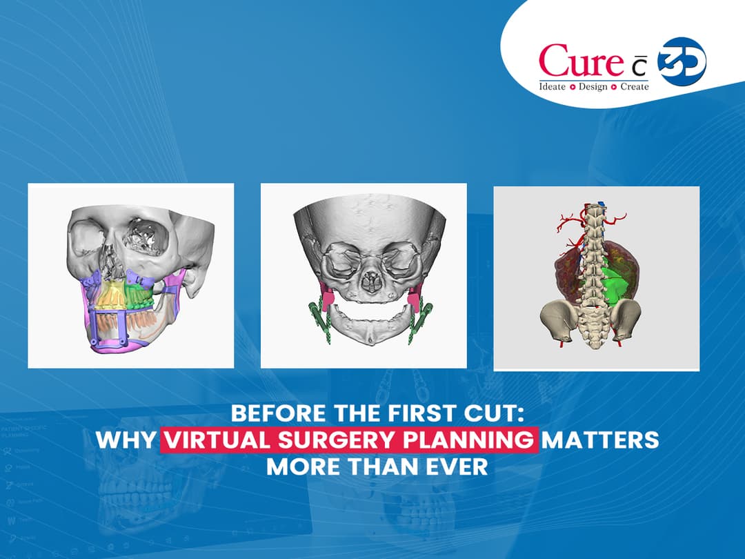 Before the First Cut: Why Virtual Surgery Planning Matters More Than Ever