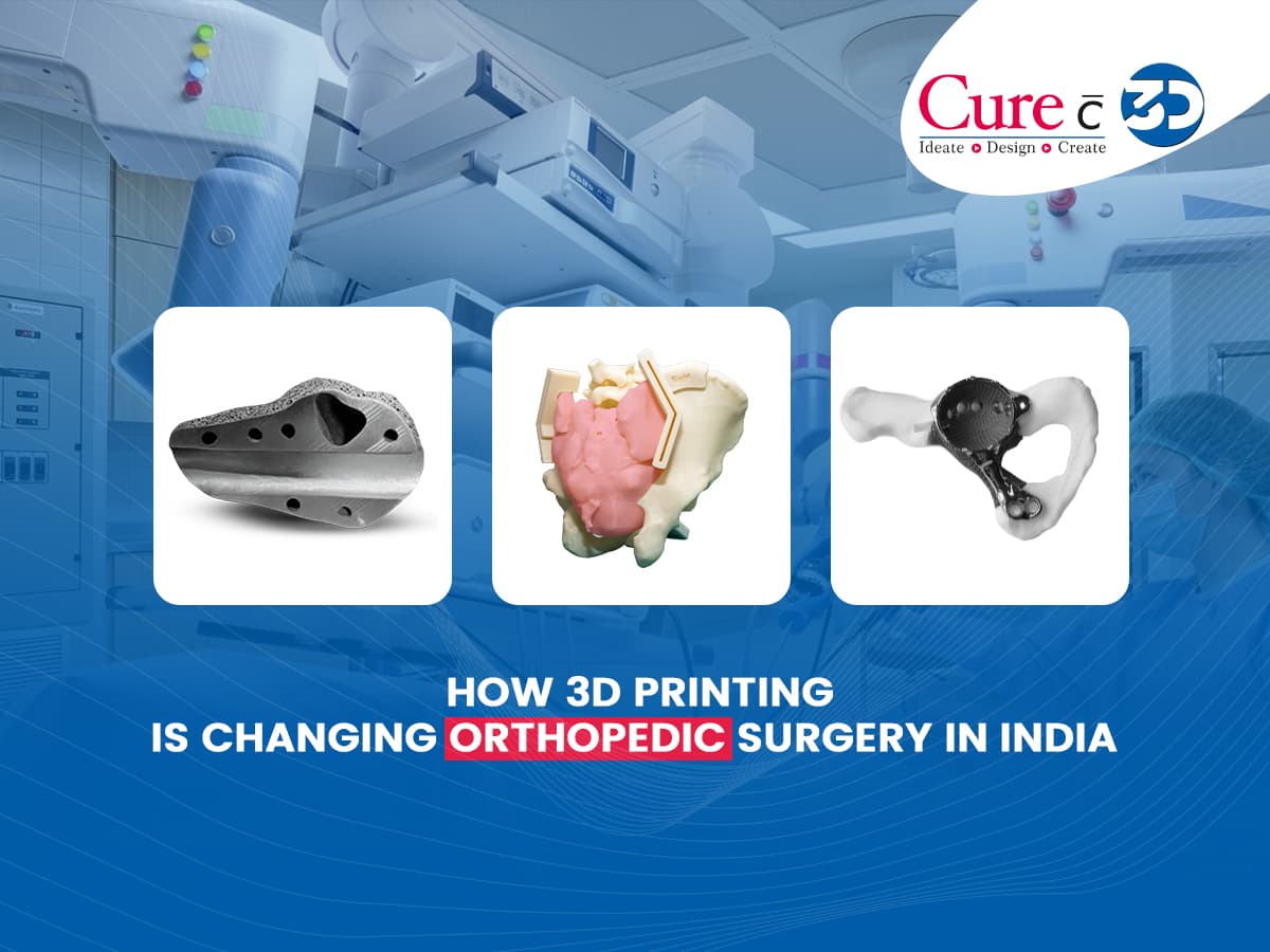 How 3D Printing is Changing Orthopedic Surgery in India