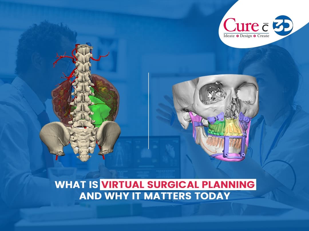What is Virtual Surgery Planning and Why it Matters Today